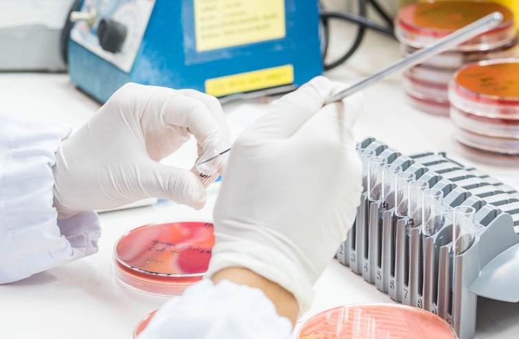 Gloved hands preparing samples with petri dishes and test tubes for infectious disease testing.